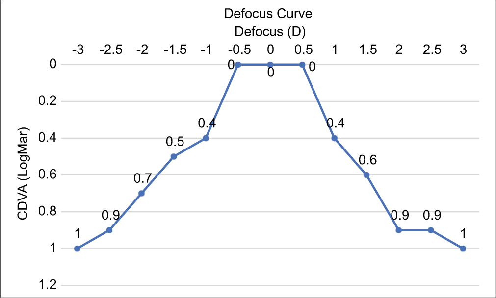 Defocus curve. CDVA: Corrected distance visual acuity.